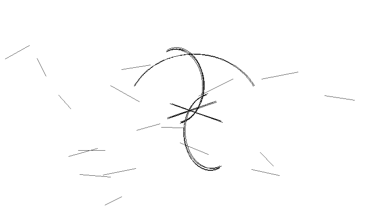 liposukce f
